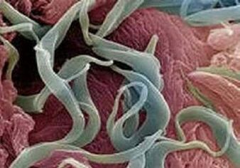 İnsan vücudundaki parazitlerin semptomları ve tedavisi