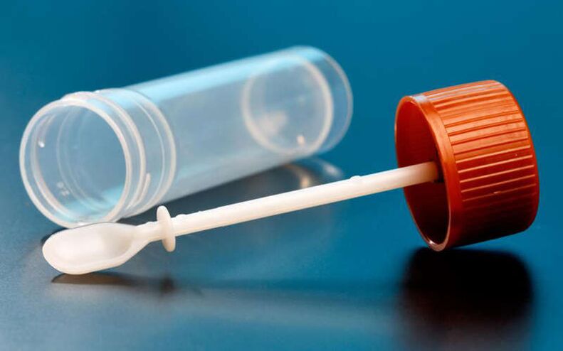 solucanlar için dışkı testi