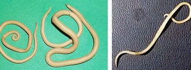 Bir insanda hangi parazitler olabilir