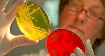 vücuttaki parazitlerin teşhisi